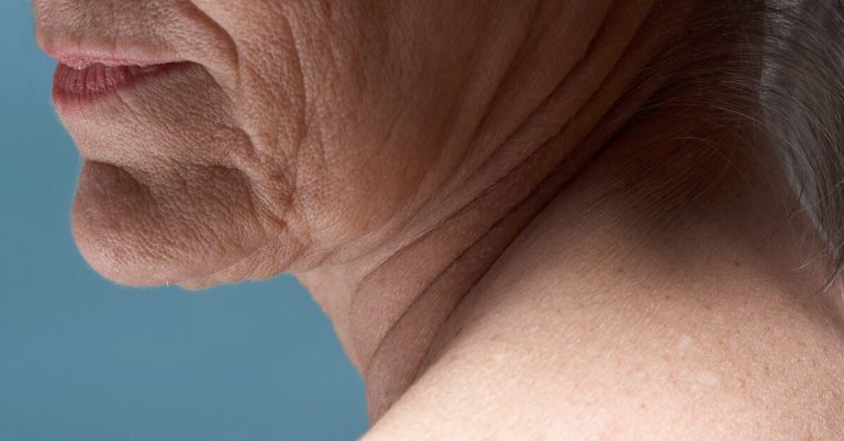 Bone spurs in the neck: symptoms, causes, and treatment