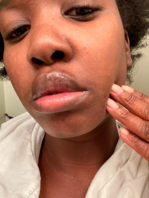 Philadelphia pays $ 2 million after police beat Rickia Young and broke windows