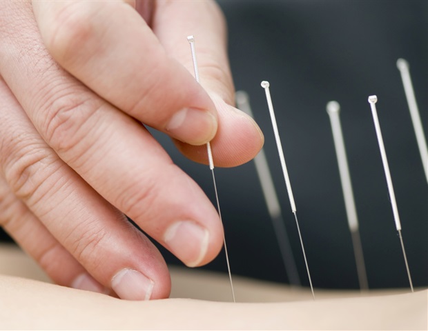 Acupuncture could help sufferers who suffer from chronic tension headaches Acupuncture may be able to help those suffering from chronic tension-type headache News-Medical.Net