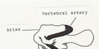 Chiropractic neck manipulations in the News Chiropractic Neck Manipulations in the News Science Based Medicine