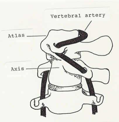 Chiropractic neck manipulations in the News Chiropractic Neck Manipulations in the News Science Based Medicine