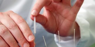 Are you suffering from headaches? A New Study Says Acupuncture May Help - WebMD