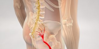 A new study has been conducted to determine OASIS treatment for sciatica people afflicted by sciatica. Australian Seniors News