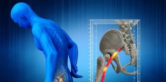 Sciatica Market : Focusing Long-Term Professional Industry and making new commitments towards The Sustainable Futur - openPR