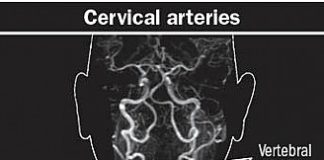 The neck is painful and severe. Could it be a sign of something more grave? - Harvard Health