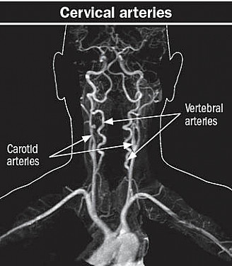 The neck is painful and severe. Could it be a sign of something more grave? – Harvard Health