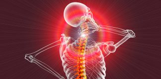 Relieving neck pain and arthritis by using low-level lasers Chiropractic Economics