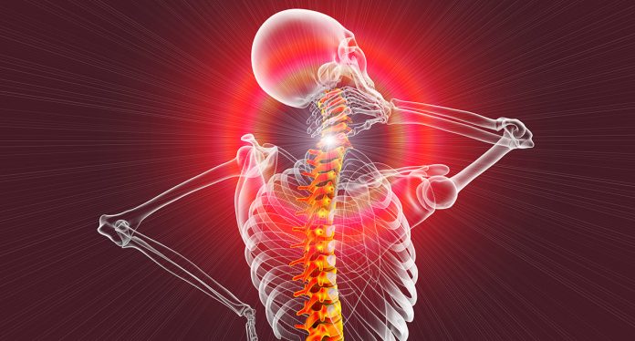 Relieving neck pain and arthritis by using low-level lasers Chiropractic Economics