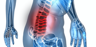 Can a Bulging Disc Cause Abdominal Pain