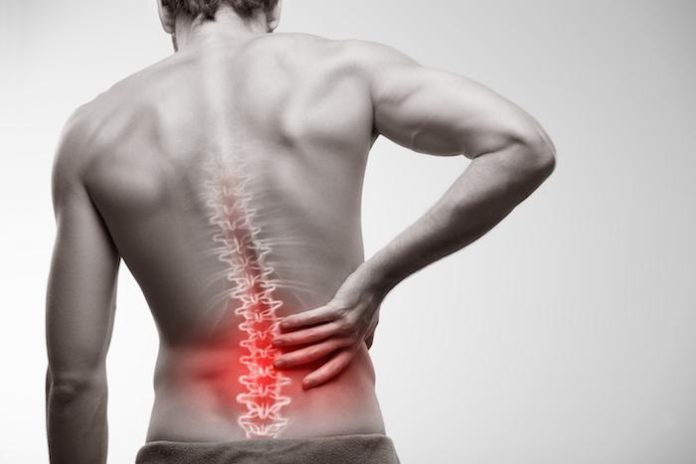 can you have sciatica without back pain