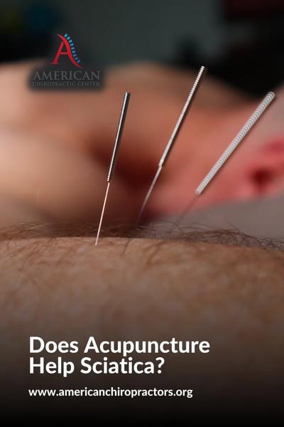 content machine american chiropractors photos a - Does Acupuncture Help Sciatica?