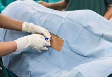 Everything you should be aware of about epidural or spinal headaches The Indian Express